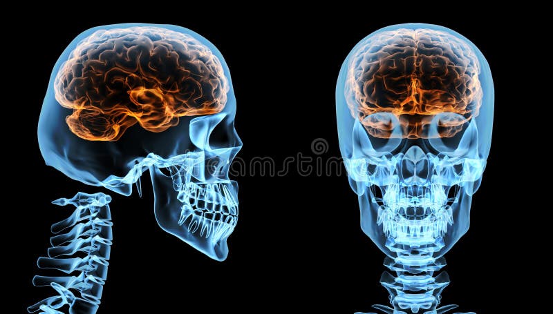 brain-inside-skull-27142243.jpg