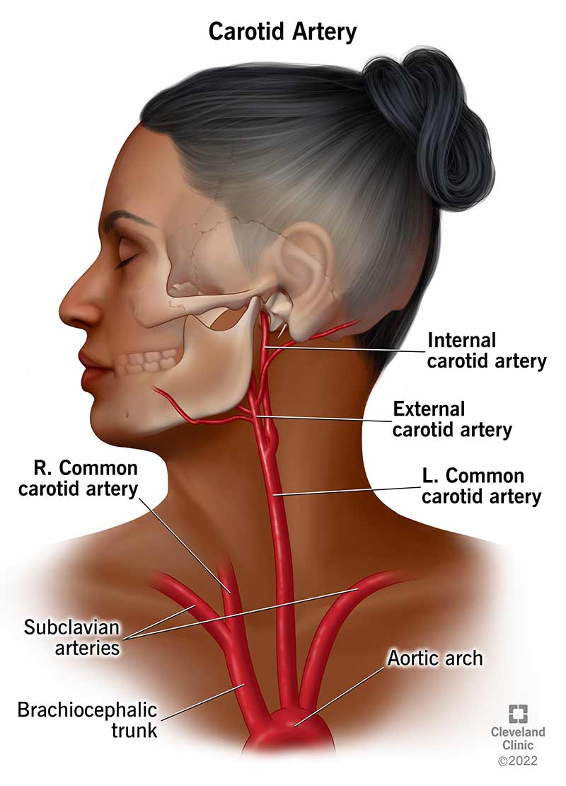 21492-carotid-artery