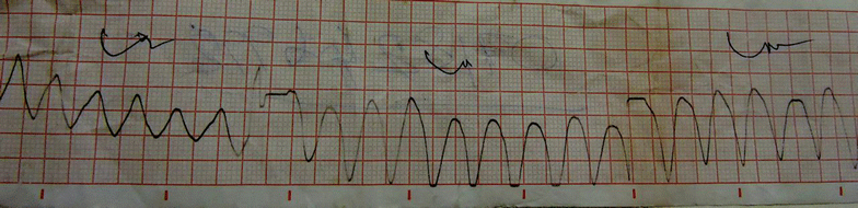 bmcresnotes.biomedcentral.com